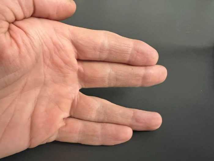 hand - fisting in sex